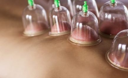 MyofascialCuppingBox