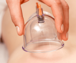 Cupping Cupping