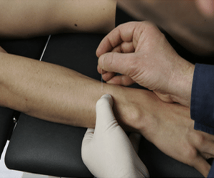 Extensor Pollicus Longus Extensor Pollicus Longus